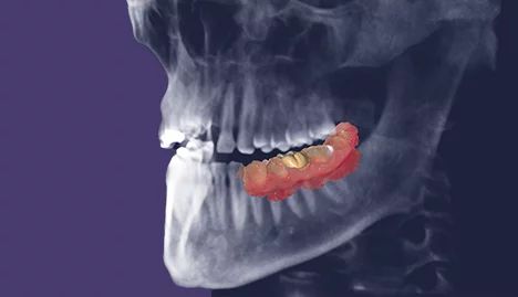 exocad - przeglądarka DICOM