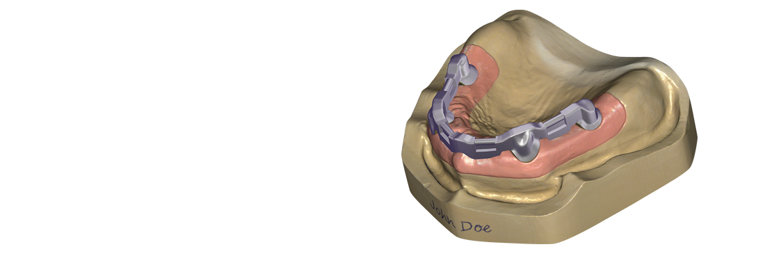 Exocad DentalCAD